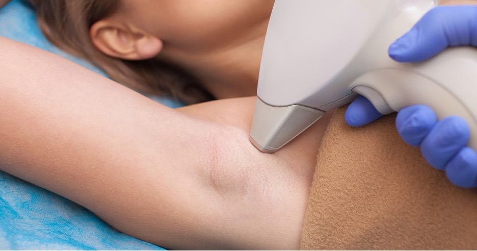 laser treatment for hair removal device