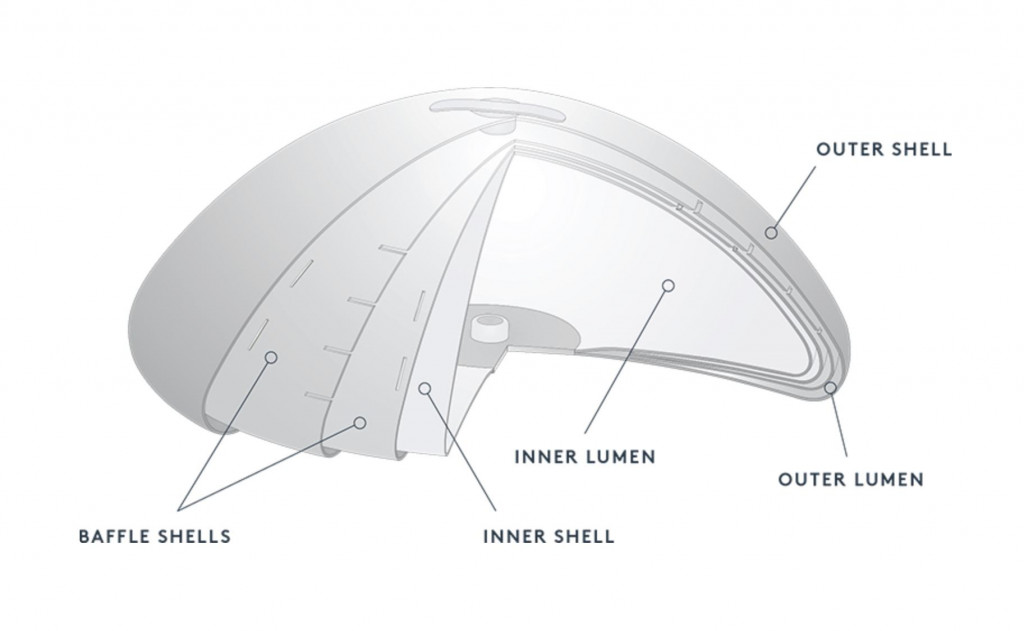 implant diagram