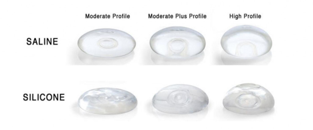 breast augmentation implant profiles