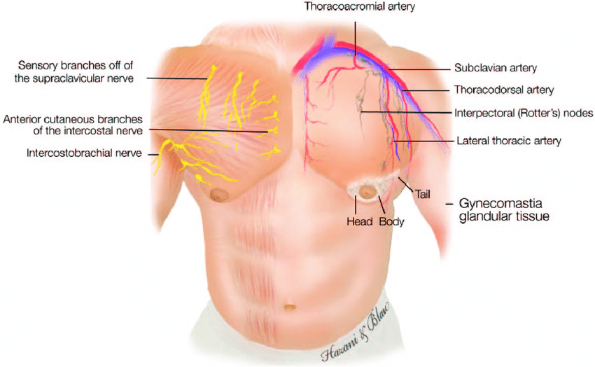 Gynecomastia male chest front view