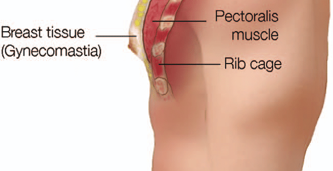 Male chest layers with fat