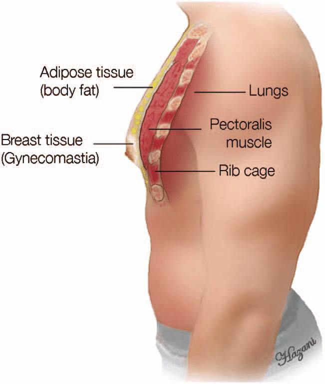 Male chest layers with fat