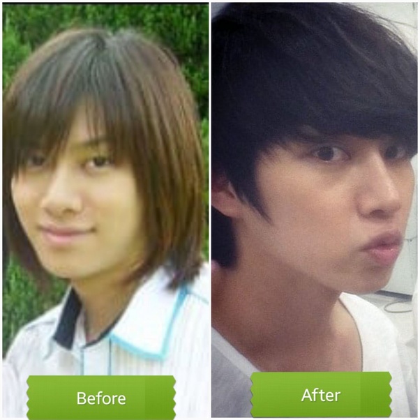 heechul before and after celebrity plastic surgery