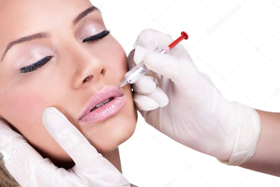 Lip filler in Calgary Alberta